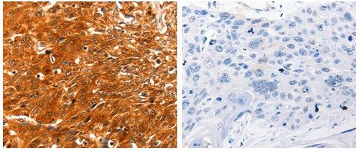 Immunohistochemistry (Formalin/PFA-fixed paraffin-embedded sections) - Anti-MASPIN antibody (AB182785), expandable thumbnail