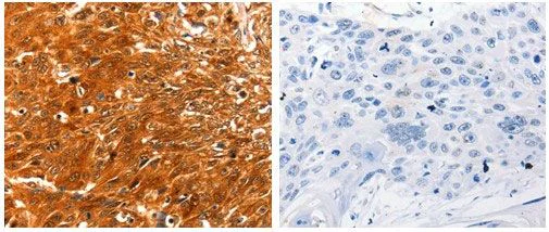 Immunohistochemistry (Formalin/PFA-fixed paraffin-embedded sections) - Anti-MASPIN antibody (AB182785)