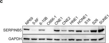 Western blot - Anti-MASPIN antibody (AB182785)