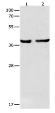 Western blot - Anti-MASPIN antibody (AB182785)