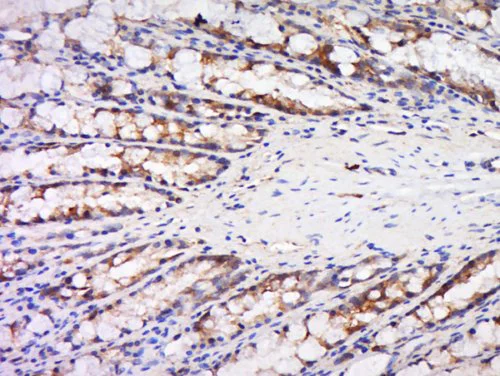 Immunohistochemistry (Formalin/PFA-fixed paraffin-embedded sections) - Anti-MASPIN antibody (AB216481)