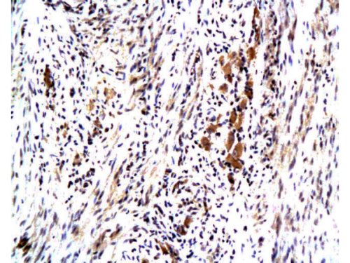 Immunohistochemistry (Formalin/PFA-fixed paraffin-embedded sections) - Anti-MASPIN antibody (AB216481)