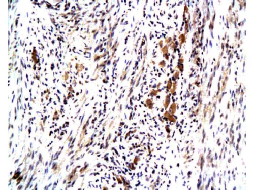 Immunohistochemistry (Formalin/PFA-fixed paraffin-embedded sections) - Anti-MASPIN antibody (AB216481)