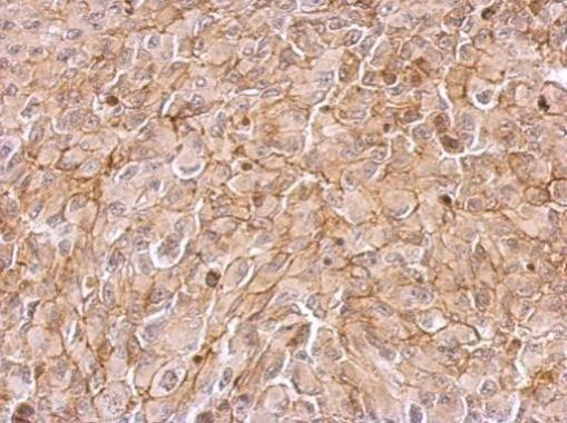 Immunohistochemistry (Formalin/PFA-fixed paraffin-embedded sections) - Anti-MASPIN antibody (AB272858)