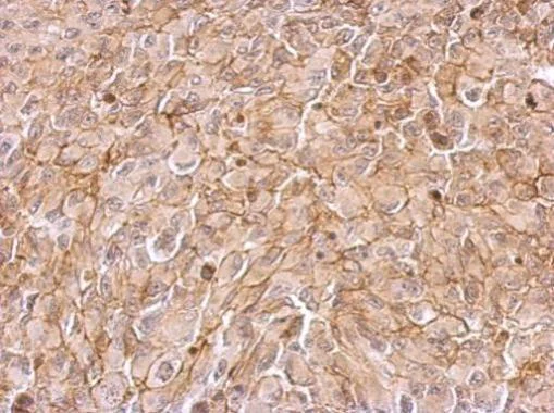 Immunohistochemistry (Formalin/PFA-fixed paraffin-embedded sections) - Anti-MASPIN antibody (AB272858)