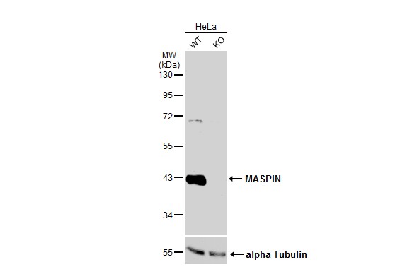 Western blot - Anti-MASPIN antibody (AB272858)