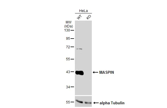 Western blot - Anti-MASPIN antibody (AB272858)