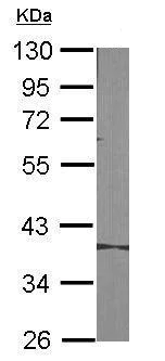 Western blot - Anti-MASPIN antibody (AB272858)