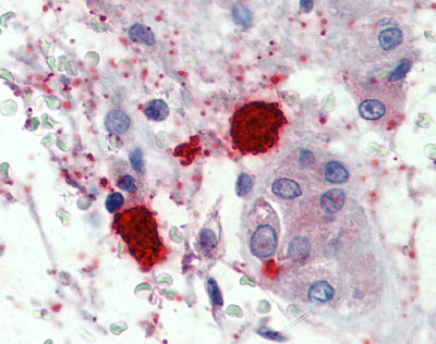 Immunohistochemistry (Formalin/PFA-fixed paraffin-embedded sections) - Anti-Mast Cell Chymase antibody (AB111239)