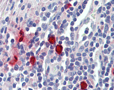 Immunohistochemistry (Formalin/PFA-fixed paraffin-embedded sections) - Anti-Mast Cell Chymase antibody (AB111239)