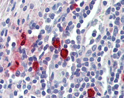 Immunohistochemistry (Formalin/PFA-fixed paraffin-embedded sections) - Anti-Mast Cell Chymase antibody (AB111239)