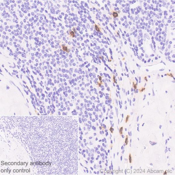 Immunohistochemistry (Formalin/PFA-fixed paraffin-embedded sections) - Anti-Mast Cell Chymase antibody [CC1] (AB2377), expandable thumbnail