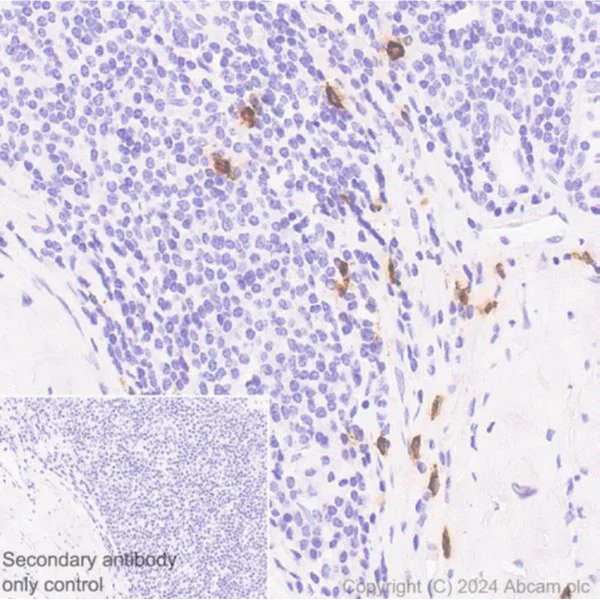 Immunohistochemistry (Formalin/PFA-fixed paraffin-embedded sections) - Anti-Mast Cell Chymase antibody [CC1] (AB2377)