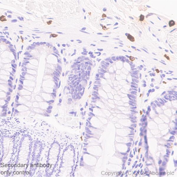 Immunohistochemistry (Formalin/PFA-fixed paraffin-embedded sections) - Anti-Mast Cell Chymase antibody [CC1] (AB2377), expandable thumbnail