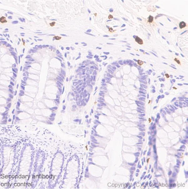 Immunohistochemistry (Formalin/PFA-fixed paraffin-embedded sections) - Anti-Mast Cell Chymase antibody [CC1] (AB2377)