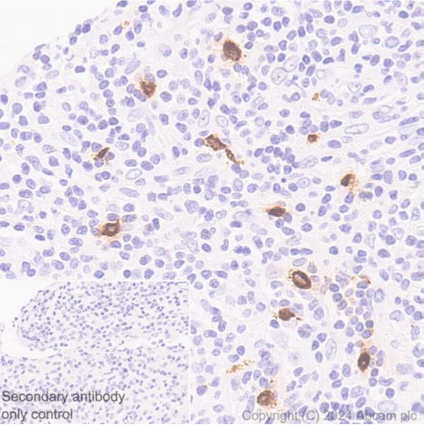 Immunohistochemistry (Formalin/PFA-fixed paraffin-embedded sections) - Anti-Mast Cell Chymase antibody [CC1] (AB2377)