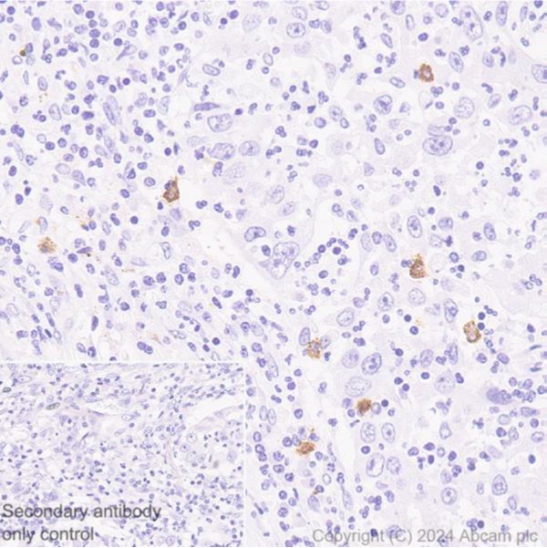 Immunohistochemistry (Formalin/PFA-fixed paraffin-embedded sections) - Anti-Mast Cell Chymase antibody [CC1] (AB2377), expandable thumbnail