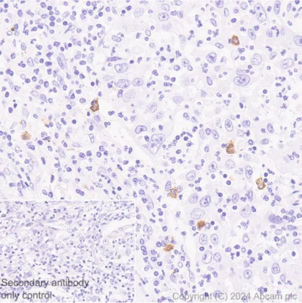 Immunohistochemistry (Formalin/PFA-fixed paraffin-embedded sections) - Anti-Mast Cell Chymase antibody [CC1] (AB2377)