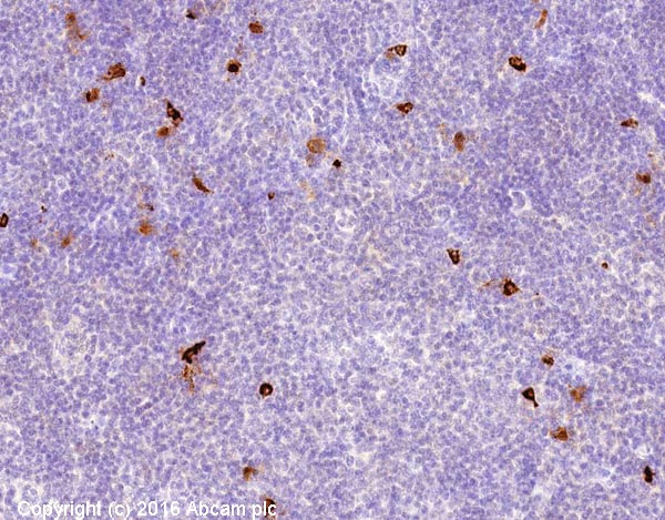 Anti-Mast Cell Chymase antibody [CC1] (ab2377) | Abcam