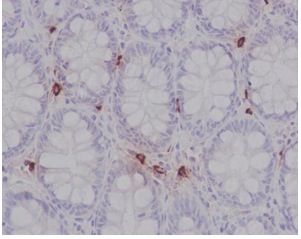 Immunohistochemistry (Formalin/PFA-fixed paraffin-embedded sections) - Anti-Mast Cell Chymase antibody [EPR13136] - BSA and Azide free (AB233729)