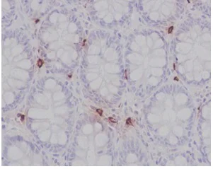 Immunohistochemistry (Formalin/PFA-fixed paraffin-embedded sections) - Anti-Mast Cell Chymase antibody [EPR13136] - C-terminal (AB186417)