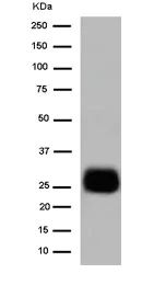 Western blot - Anti-Mast Cell Chymase antibody [EPR13136] - C-terminal (AB186417)