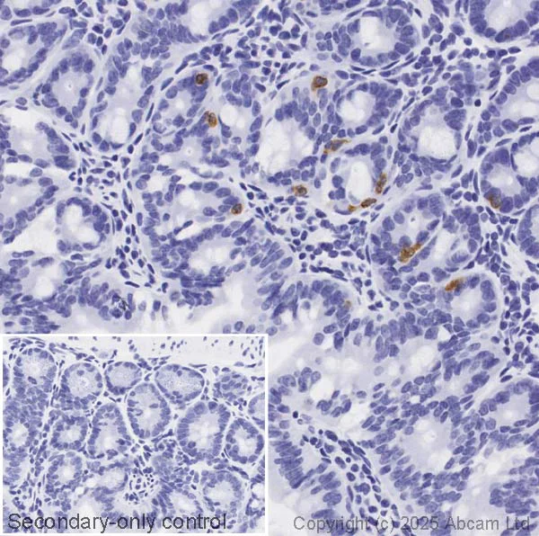 Immunohistochemistry (Formalin/PFA-fixed paraffin-embedded sections) - Anti-Mast cell protease 1 antibody [EPR25920A-86] (AB324633)