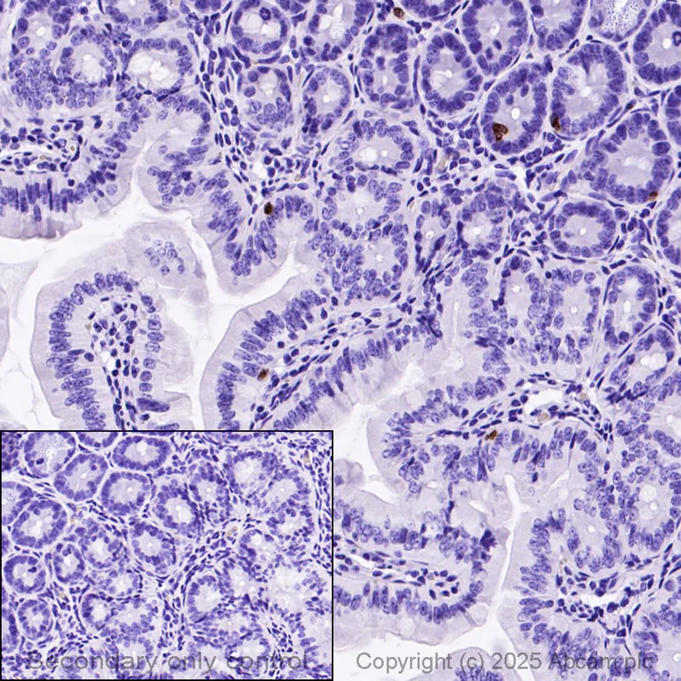 Immunohistochemistry (Formalin/PFA-fixed paraffin-embedded sections) - Anti-Mast cell protease 1 antibody [EPR25920A-86] (AB324633)