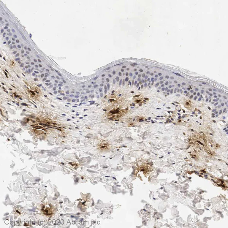 Immunohistochemistry (Formalin/PFA-fixed paraffin-embedded sections) - Anti-Mast Cell Tryptase antibody [AA1] (AB2378)