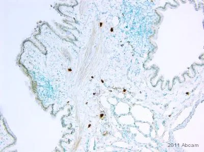 Immunohistochemistry (Formalin/PFA-fixed paraffin-embedded sections) - Anti-Mast Cell Tryptase antibody [AA1] (AB2378)