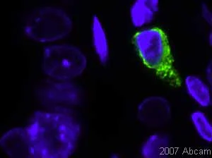 Immunohistochemistry (Formalin/PFA-fixed paraffin-embedded sections) - Anti-Mast Cell Tryptase antibody [AA1] (AB2378)