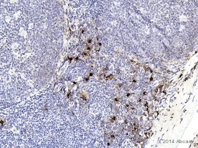 Immunohistochemistry (Formalin/PFA-fixed paraffin-embedded sections) - Anti-Mast Cell Tryptase antibody [AA1] (AB2378)