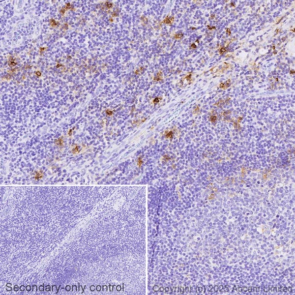 Immunohistochemistry (Formalin/PFA-fixed paraffin-embedded sections) - Anti-Mast Cell Tryptase antibody [AA1] (AB2378)