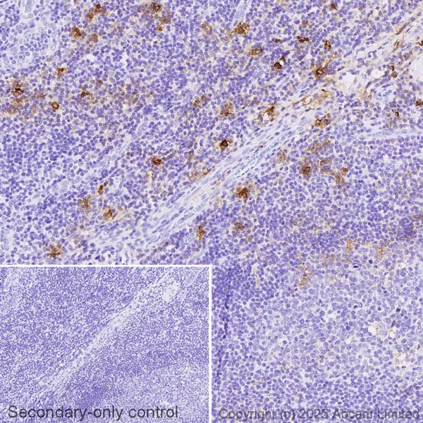 Immunohistochemistry (Formalin/PFA-fixed paraffin-embedded sections) - Anti-Mast Cell Tryptase antibody [AA1] (AB2378)