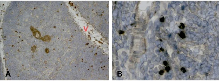 Immunohistochemistry (Formalin/PFA-fixed paraffin-embedded sections) - Anti-Mast Cell Tryptase antibody [AA1] (AB2378)