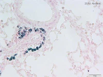 Immunohistochemistry (Formalin/PFA-fixed paraffin-embedded sections) - Anti-Mast Cell Tryptase antibody [AA1] (AB2378)