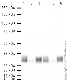 Western blot - Anti-Mast Cell Tryptase antibody [AA1] (AB2378)