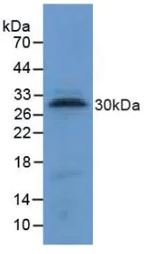 Western blot - Anti-Mast Cell Tryptase antibody (AB231714)