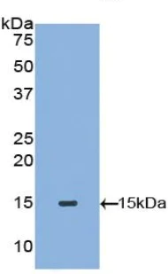 Western blot - Anti-Mast Cell Tryptase antibody (AB231714)