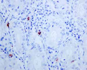 Immunohistochemistry (Formalin/PFA-fixed paraffin-embedded sections) - Anti-Mast Cell Tryptase antibody [EPR8475] (AB134931), expandable thumbnail