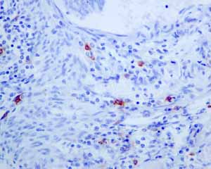 Immunohistochemistry (Formalin/PFA-fixed paraffin-embedded sections) - Anti-Mast Cell Tryptase antibody [EPR8475] (AB134931), expandable thumbnail