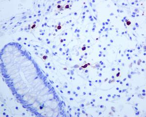 Immunohistochemistry (Formalin/PFA-fixed paraffin-embedded sections) - Anti-Mast Cell Tryptase antibody [EPR8475] (AB134931), expandable thumbnail