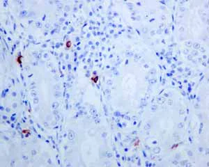 Immunohistochemistry (Formalin/PFA-fixed paraffin-embedded sections) - Anti-Mast Cell Tryptase antibody [EPR8475] - BSA and Azide free (AB227573)