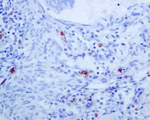 Immunohistochemistry (Formalin/PFA-fixed paraffin-embedded sections) - Anti-Mast Cell Tryptase antibody [EPR8475] - BSA and Azide free (AB227573)