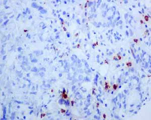 Immunohistochemistry (Formalin/PFA-fixed paraffin-embedded sections) - Anti-Mast Cell Tryptase antibody [EPR8475] - BSA and Azide free (AB227573)