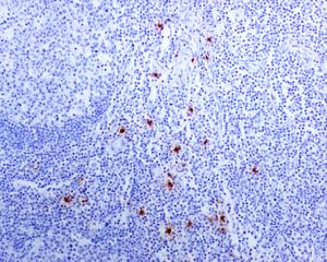 Immunohistochemistry (Formalin/PFA-fixed paraffin-embedded sections) - Anti-Mast Cell Tryptase antibody [EPR8475] - BSA and Azide free (AB227573)