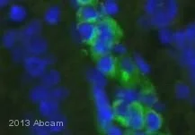 Immunohistochemistry (Formalin/PFA-fixed paraffin-embedded sections) - Anti-Mast Cell Tryptase antibody [EPR8476] (AB134932)