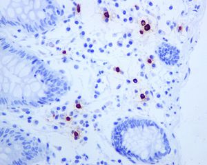 Immunohistochemistry (Formalin/PFA-fixed paraffin-embedded sections) - Anti-Mast Cell Tryptase antibody [EPR8476] (AB134932)