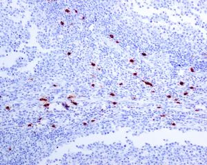 Immunohistochemistry (Formalin/PFA-fixed paraffin-embedded sections) - Anti-Mast Cell Tryptase antibody [EPR8476] - BSA and Azide free (AB227572)