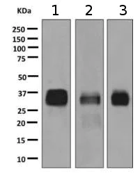 Western blot - Anti-Mast Cell Tryptase antibody [EPR9522] (AB151757)